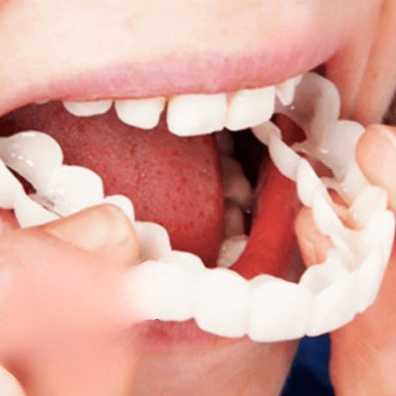 1+1 Gratis | Mould - Herausnehmbare Zahnprothese für Ober- und Unterkiefer