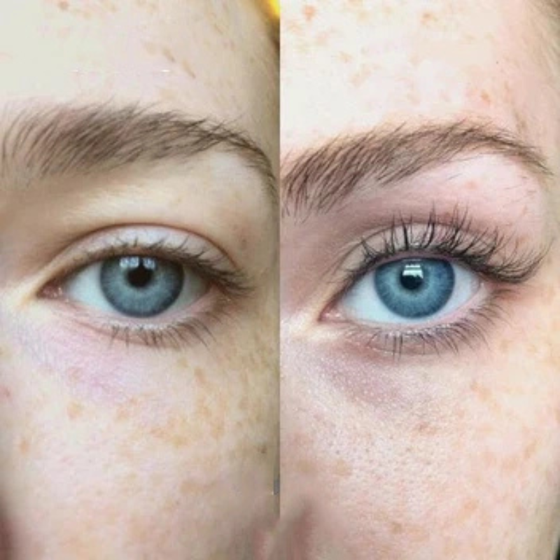 1+1 Gratis | Lash - Wimpernserum zur gezielten Wimpernpflege