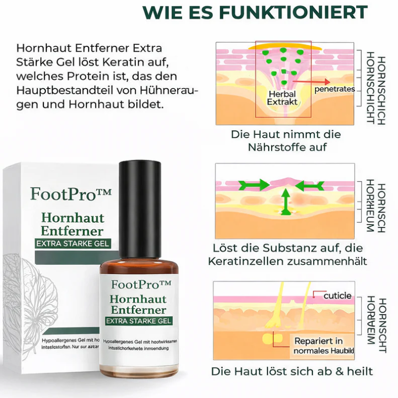 Hornhautentferner für Hühneraugen Mit Punktgenauer Applikator für präzise Anwendung | 1+1 GRATIS