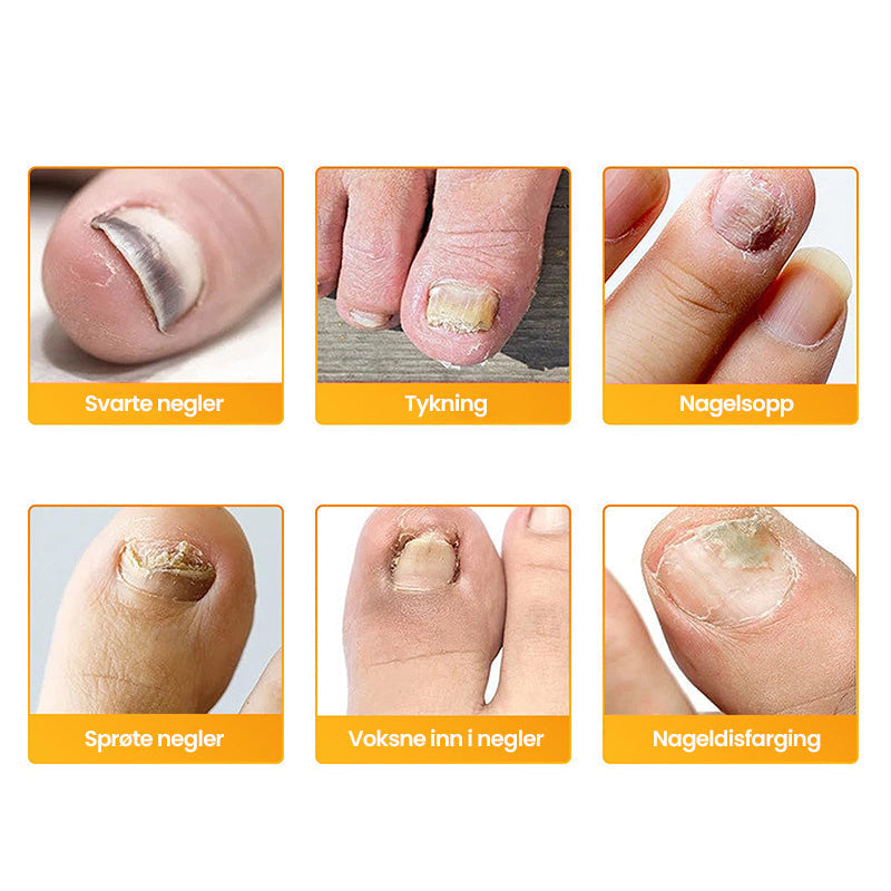 1+1 Gratis | Clear - Nagelpflege-Pflaster für die tägliche Anwendung