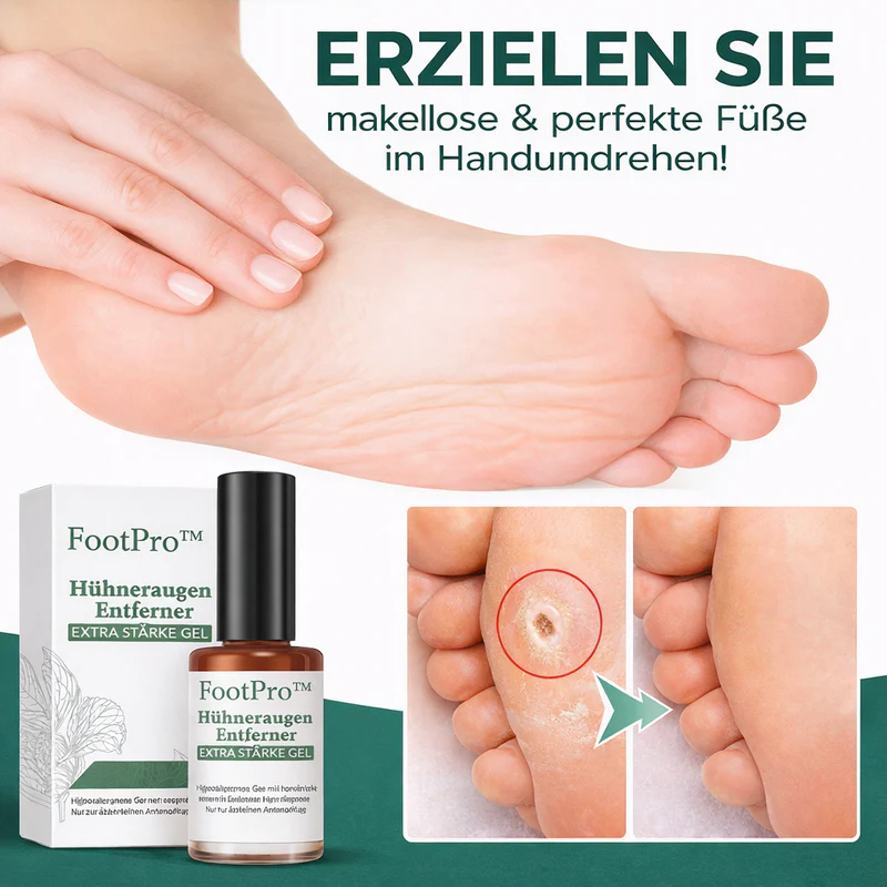 Hornhautentferner für Hühneraugen Mit Punktgenauer Applikator für präzise Anwendung | 1+1 GRATIS