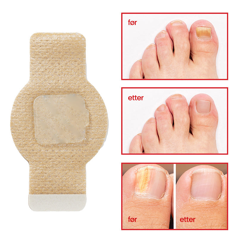 1+1 Gratis | Clear - Nagelpflege-Pflaster für die tägliche Anwendung