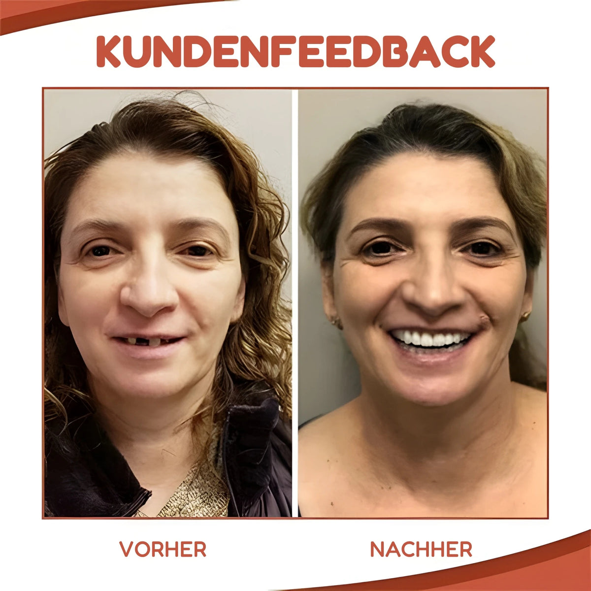 Dentavia Kundenfeedback – vorher und nachher