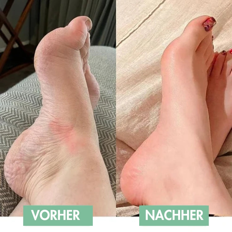 Motion - Elektrisches Fußmassagegerät mit 8 Massage-Modi