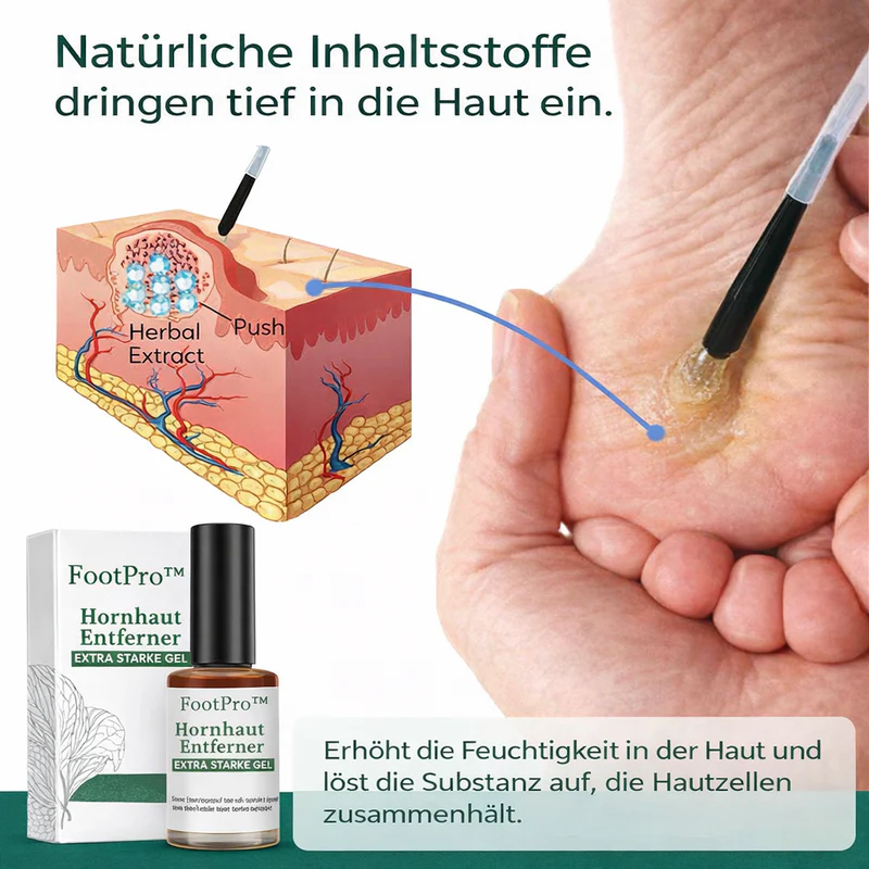 Hornhautentferner für Hühneraugen Mit Punktgenauer Applikator für präzise Anwendung | 1+1 GRATIS