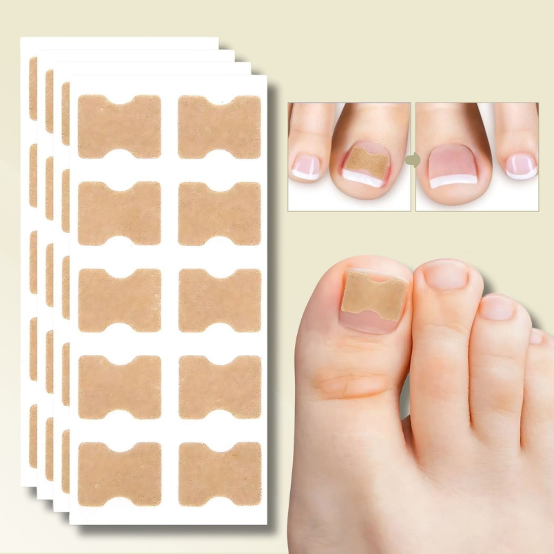 Nagelkorrektur Spange gegen eingewachsene Nägel | 10+10 GRATIS