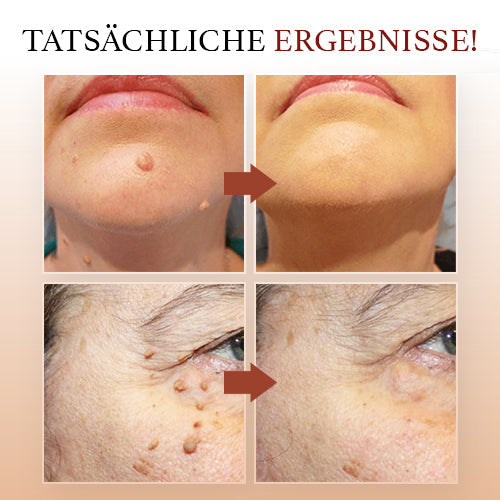 1+1 GRATIS | Purity - Hautpflege-Serum mit Teebaumöl für klare Haut