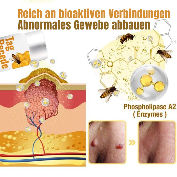 Warzenentferner | Warzen Spray | Bienengift Formel | Schmerzfrei | SkinPurex