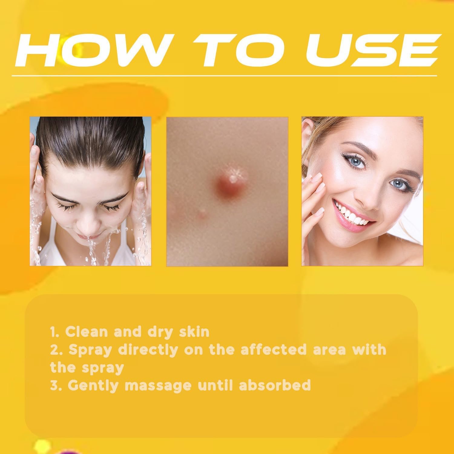 Warzenentferner | Zielgerichtetes Hautspray | Bienengift Pflegeformel | TagAway