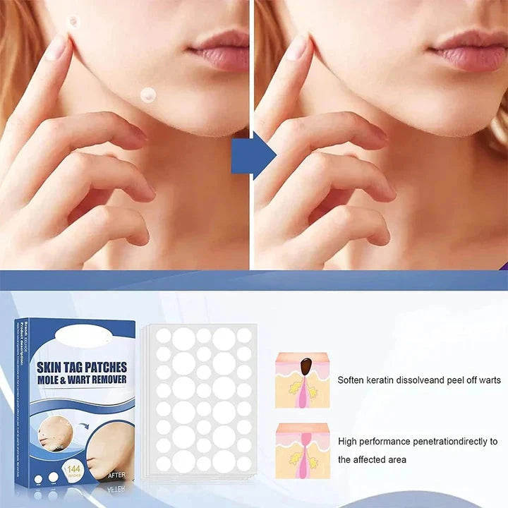 Patchora - Hautpflaster mit Teebaumöl und Vitamin E zur Anwendung auf der Haut