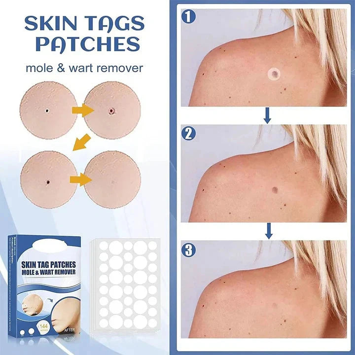 Patchora - Hautpflaster mit Teebaumöl und Vitamin E zur Anwendung auf der Haut