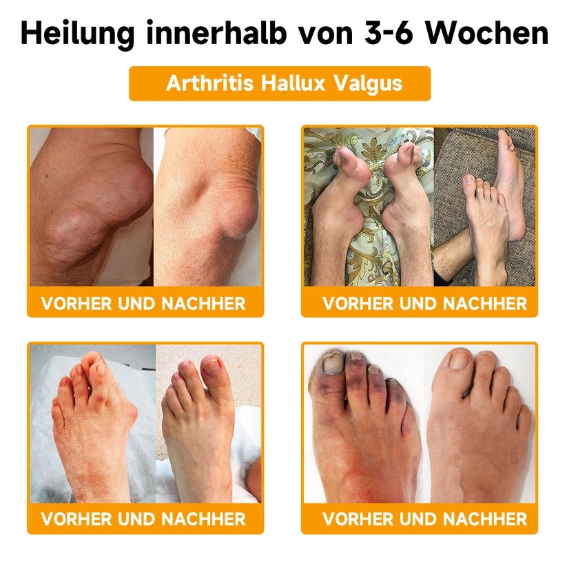 1+1 Gratis | Beevane - Gesichtscreme mit Bienengift Hyaluronsäure und Kollagen